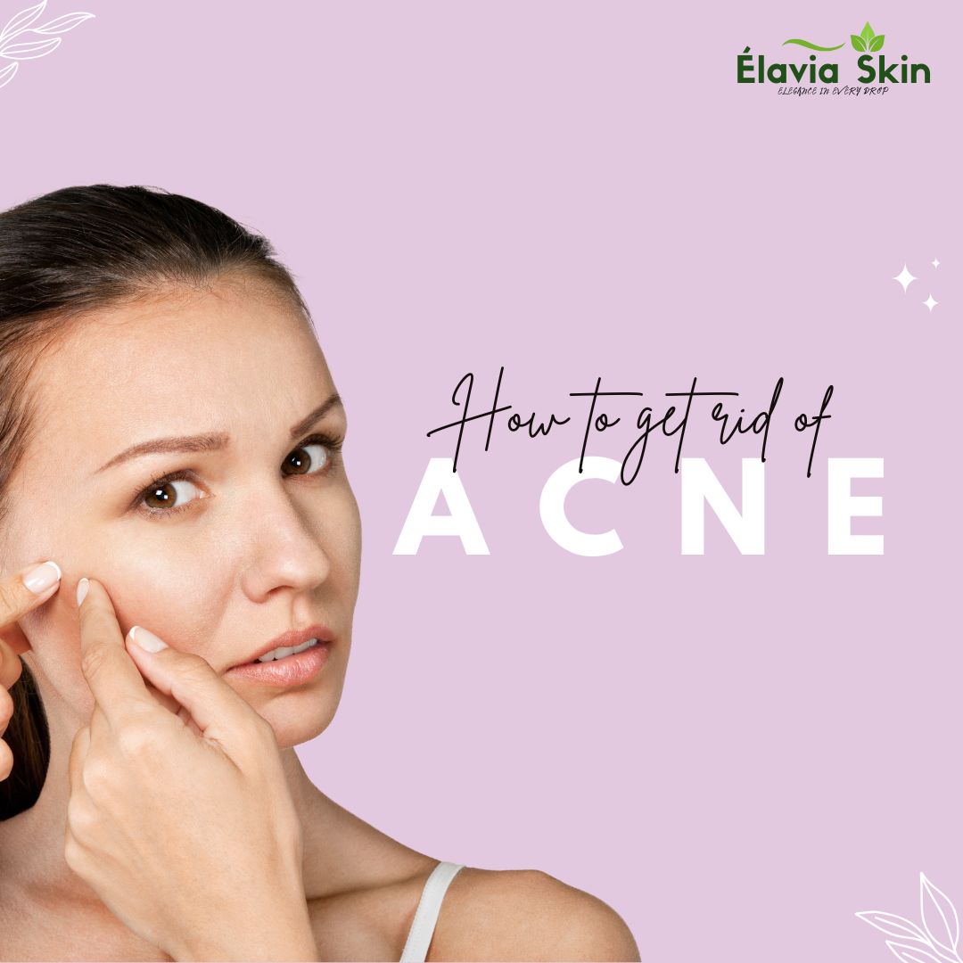 Pimples & Acne Control Cosmetic, Remove Acne, Remove Pimple